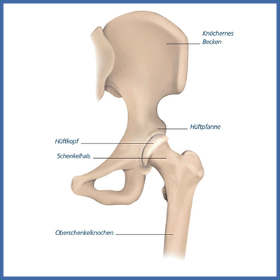 Ursachen Hüftgelenksleiden